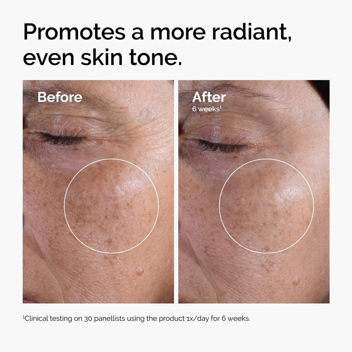 The Ordinary Glycolic Acid 7% Exfoliating Toner for Radiant Skin