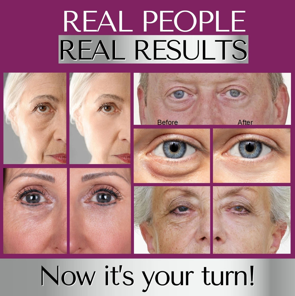 Instant Eye Bag Remover Serum Under-Eye Puffiness & Wrinkle Care