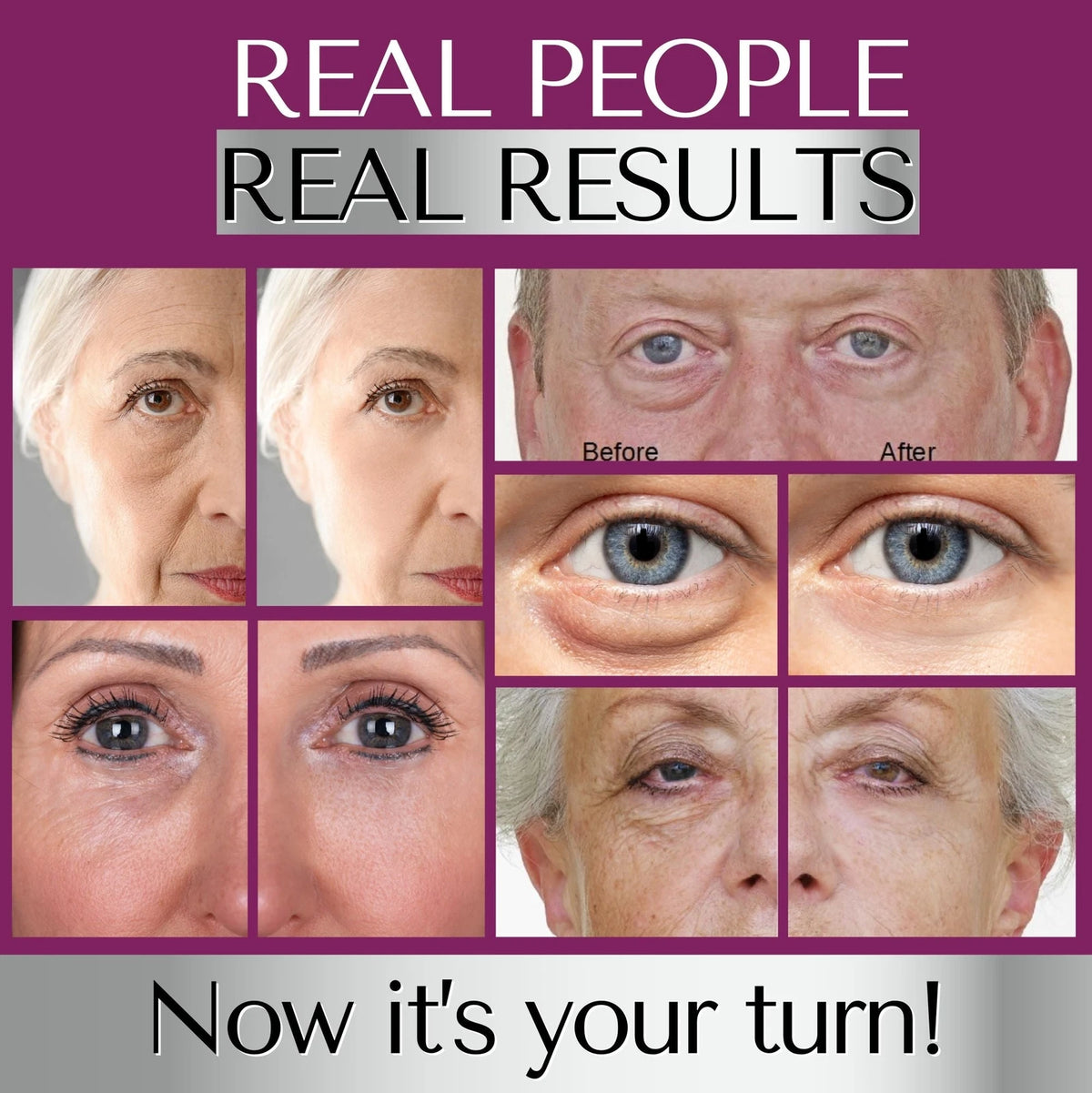 Instant Eye Bag Remover Serum Under-Eye Puffiness & Wrinkle Care