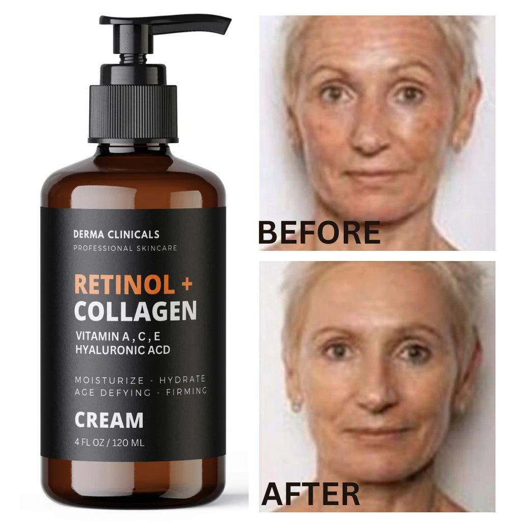 Retinol Collagen Face Cream with Hyaluronic Acid & Vitamin C – Anti-Aging 4oz