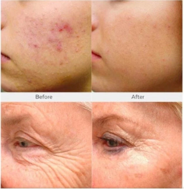 Retinol Collagen Face Cream with Hyaluronic Acid & Vitamin C – Anti-Aging 4oz