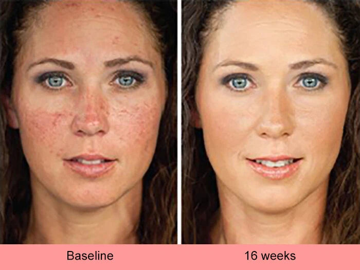 Kojic Acid Brightening Serum – Dark Spot Corrector
