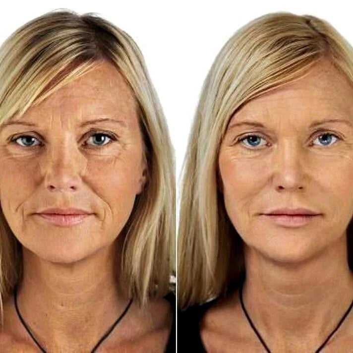 Retinol Collagen Face Cream with Hyaluronic Acid & Vitamin C – Anti-Aging 4oz