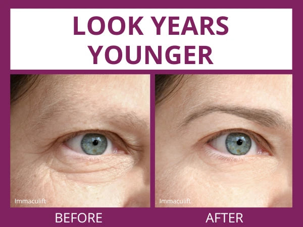 Instant Eye Bag Remover Serum Under-Eye Puffiness & Wrinkle Care