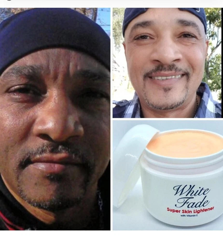 White Fade Super Skin Lightener Cream – 2 OZ
