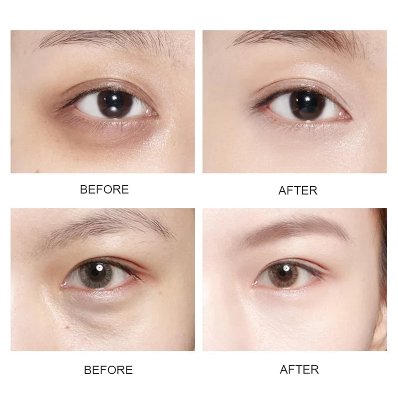 60pcs Vitamin C Collagen Hydrogel Under Eye Patches – Brightening & Anti-Aging