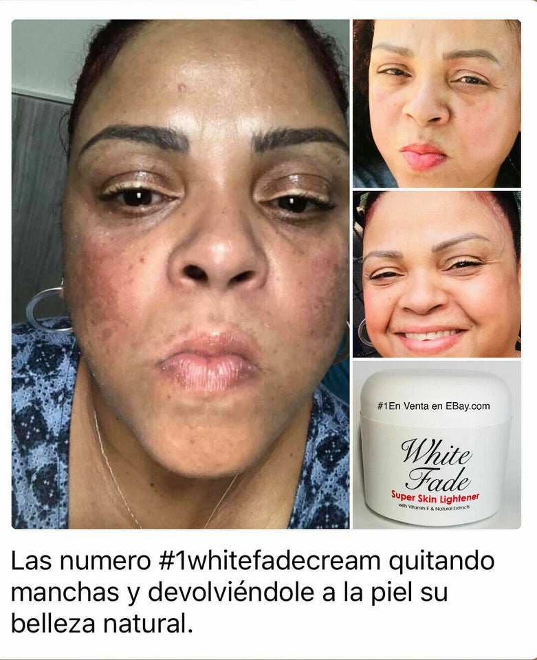 Super Skin Lightening Cream – Effective Dark Spot Treatment
