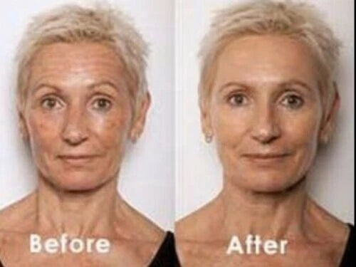 Retinol Collagen Face Cream with Hyaluronic Acid & Vitamin C – Anti-Aging 4oz