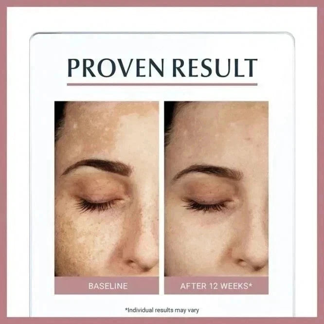 Eucerin Anti-Pigment Dual Serum for Dark Spots & Pigmentation 30ml