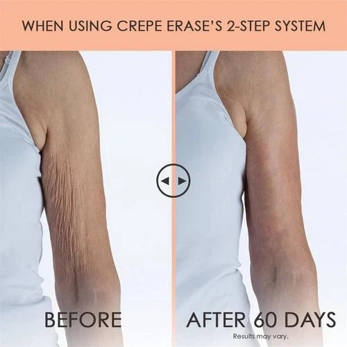 Body Firm Crepe Erase Body Treatment - 10 oz for Firm, Hydrated Skin