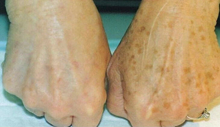 Super Skin Lightening Cream – Effective Dark Spot Treatment